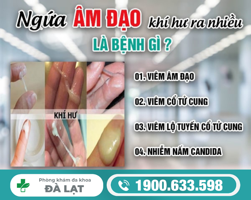 Hình ảnh minh họa